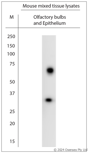 Rabbit antibody to Colon carcinoma laminin binding protein (50-100)