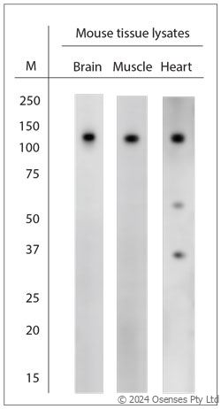Rabbit antibody to CACNA2D1 (600-650)