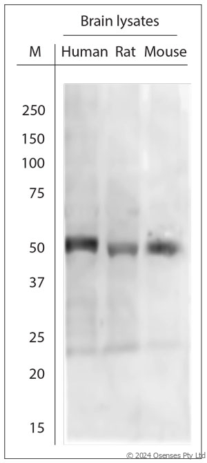 Rabbit antibody to Tyrosine Hydroxylase (30-100)