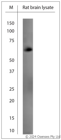 Rabbit antibody to GAD65, 67 (520-585)