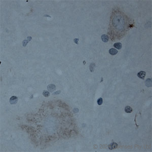 Rabbit antibody to CNTNAP2
