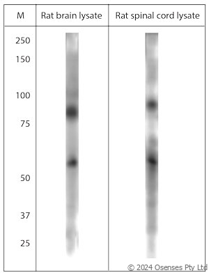 Rabbit antibody to TPC1 (750-800)