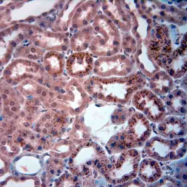 Guinea pig antibody to TMPRSS2