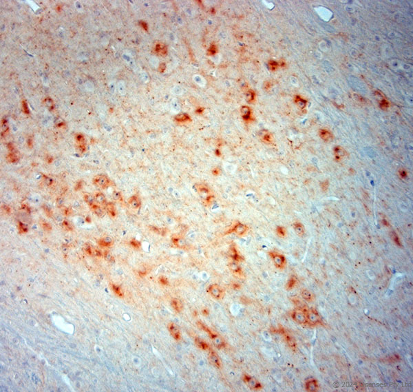 Guinea pig antibody to VMAT2