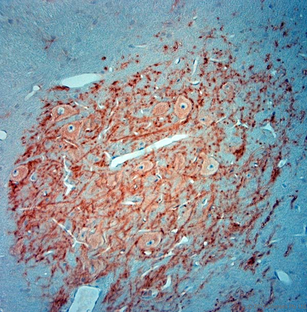 Guinea pig antibody to MAP2