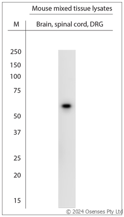 Rabbit antibody to ATP5A1 (500-550)