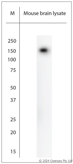 Rabbit antibody to 200 Neurofilament (150-200)