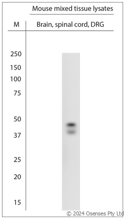 Rabbit antibody to POC1A (300-350)
