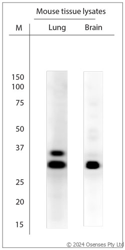 Rabbit antibody to SCAMP1 (2-50)
