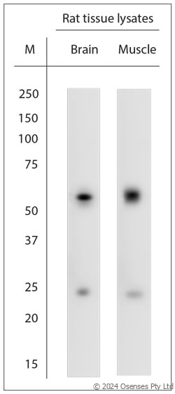 Rabbit antibody to extracellular ASIC3 (50-100)