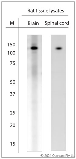 Rabbit antibody to TRPC6 (10-60)