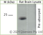 Rabbit antibody to TRAPPC5 (80-120)