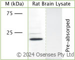 Rabbit antibody to CAV1 (30-80)