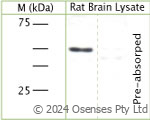 Rabbit antibody to Synaptotagmin 1 (10-60)