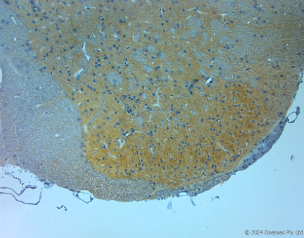 Rabbit antibody to NMDAR3A (990-1040)