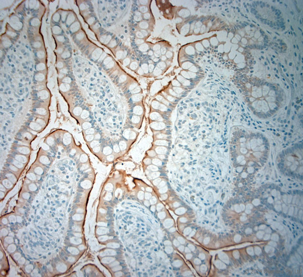 Rabbit antibody to SLC5A8 (560-610)