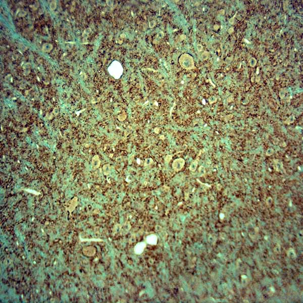 Guinea pig antibody to VGluT1